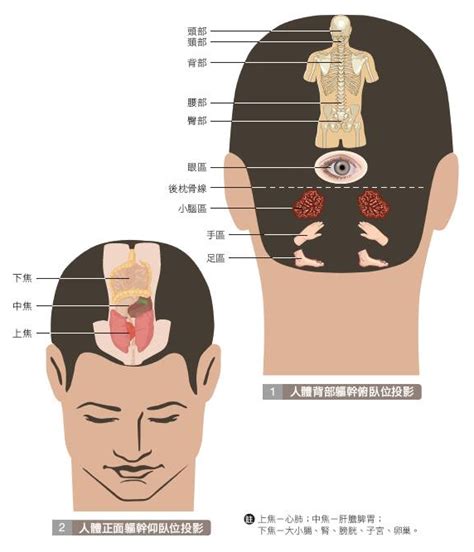 頭有壓迫感|頭部重壓感,頭部重壓感的治療